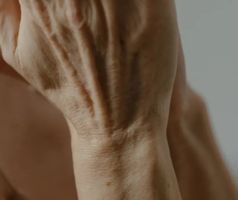 The back of a hand and wrist with thin, crepey skin