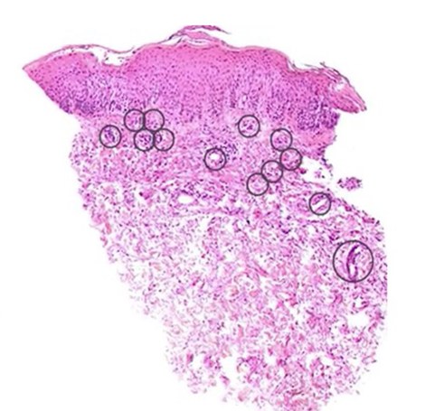Histology of the treated side: tissue filling most of the same frame.